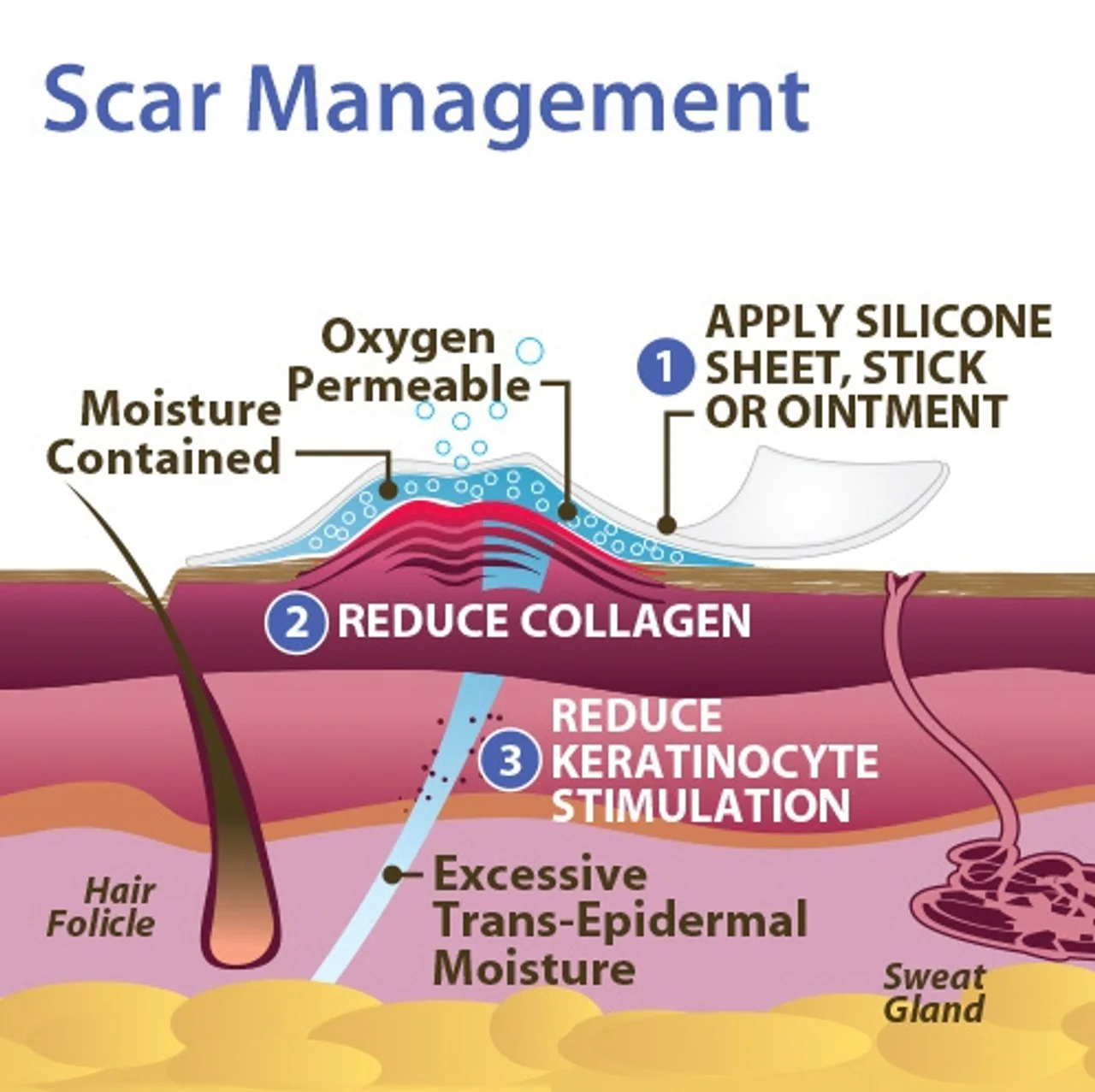 Epi-Derm Gel Mastopexy Sheet - Image 6
