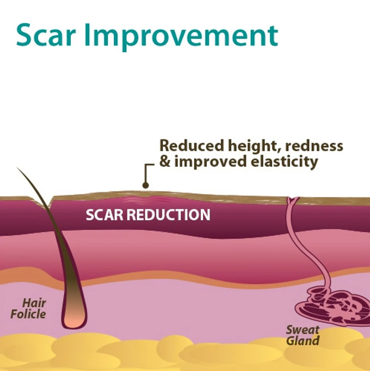 Epi-Derm Gel Mastopexy Sheet - Image 7